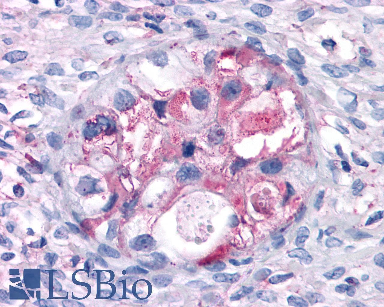 IHC-plus™ Polyclonal Rabbit anti-Human GPRC5A / RAI3 Antibody (Cytoplasmic Domain, IHC)