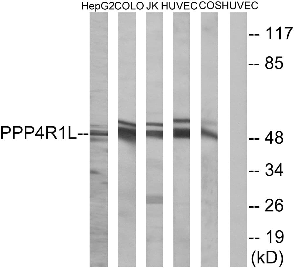 PPP4R1L Antibody