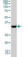 IHC-plus™ Monoclonal Mouse anti-Human SSR1 Antibody (clone 1A12, IHC, WB)