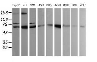 SOLO / SESTD1 Antibody (clone OTI4B10)