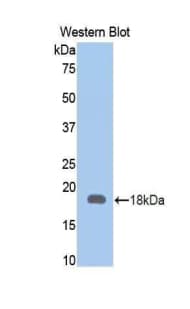 LGALS9 / Galectin 9 Antibody (aa225-353)