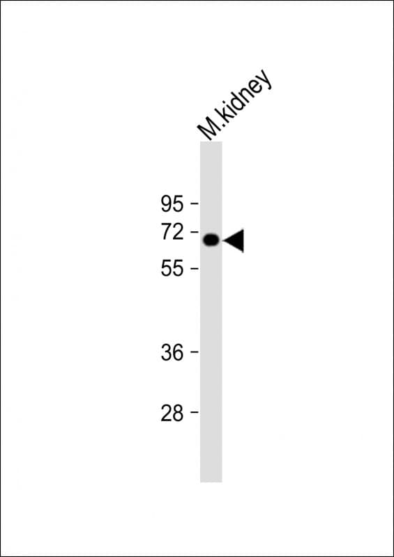 Polyclonal Rabbit anti-Human MGAT4A Antibody (N-Terminus, WB)