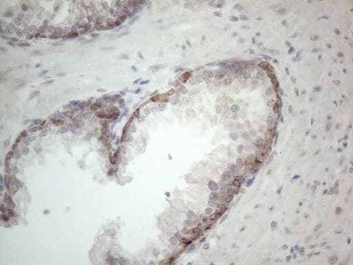 Monoclonal Mouse anti-Human RORB / ROR Beta Antibody (clone OTI1G1, aa1-260, IHC, WB)