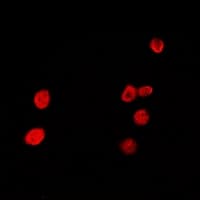 HDGFRP2 Antibody