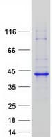 Human RP2 Protein (Recombinant Myc-DDK (Flag))