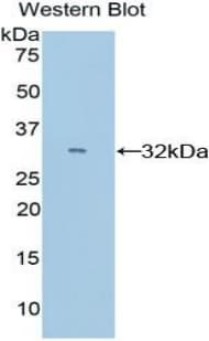 CYP26 / CYP26A1 Antibody (aa250-495)