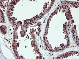 Monoclonal Mouse anti-Human SAMHD1 Antibody (clone OTI2A5, IHC, IF, WB)