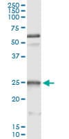 HSPB1 / HSP27 Antibody (clone 3G3)