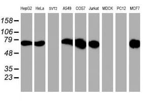 PDIA4 / ERP72 Antibody (clone OTI2F1)