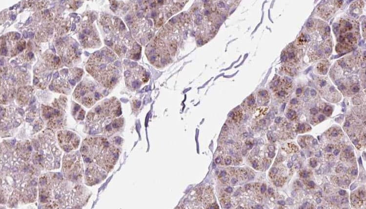 PMM2 Antibody