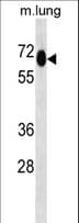 MEPCE Antibody (aa239-267)
