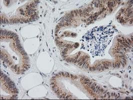 Monoclonal Mouse anti-Human MGLL / Monoacylglycerol Lipase Antibody (clone OTI1H1, IHC, IF, WB)