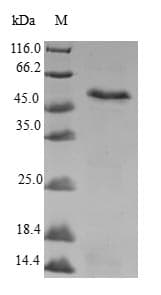 Human MRPS22 Protein (Recombinant GST, N-terminus)