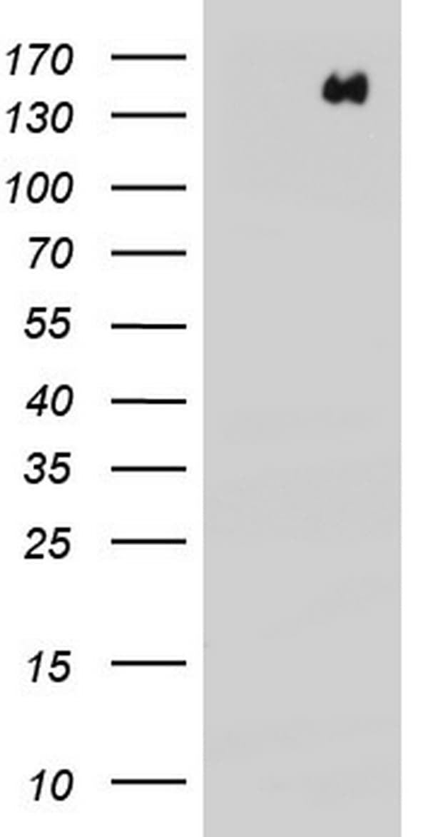 ERBB4 / HER4 Antibody (aa992-1308, clone OTI1D9)