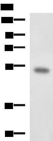 Polyclonal Rabbit anti-Human FOXQ1 Antibody (IHC, WB)
