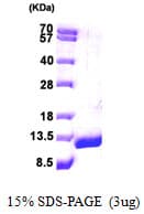 Human DBI / ACBD1 Protein (Recombinant His)
