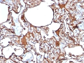 MCAM / CD146 Antibody (clone SPM620)