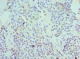 SERPINB5 / Maspin Antibody (aa21-189)