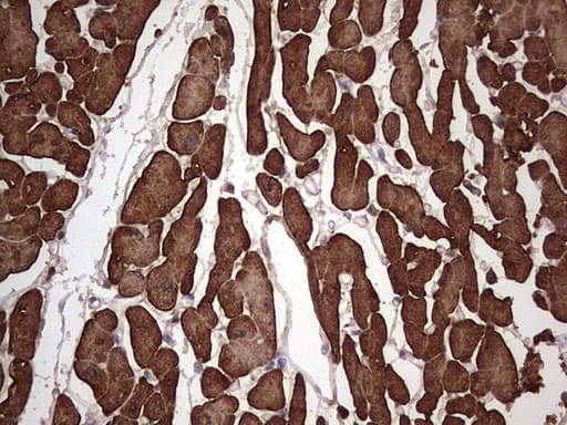 Monoclonal Mouse anti-Human TNNT2 / CTNT Antibody (clone OTI7B1, IHC, WB)