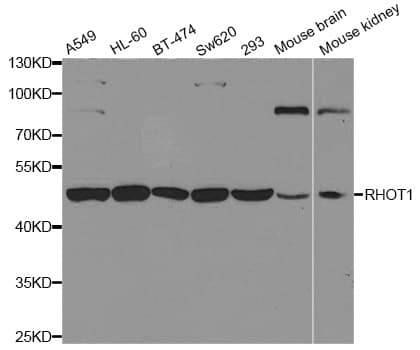 Polyclonal Rabbit anti-Human RHOT1 Antibody (IHC, WB)