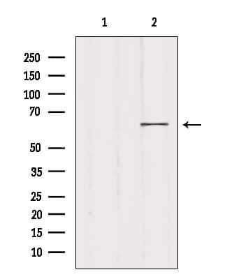 MED26 / CRSP7 Antibody