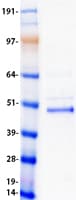 Human VSX2 / CHX10 Protein (Recombinant Myc-DDK (Flag))