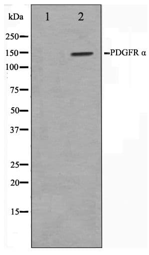 PDGFRA / PDGFR Alpha Antibody