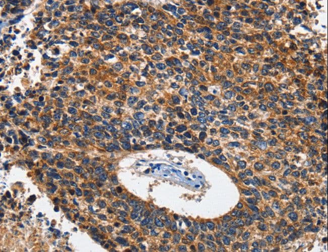 Polyclonal Rabbit anti-Human HK2 / Hexokinase 2 Antibody (IHC, WB)