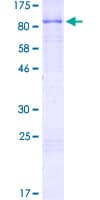 Human RAD18 Protein (Recombinant GST)