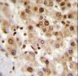 Polyclonal Rabbit anti-Human IER3 / IEX-1 Antibody (aa38-65, IHC, IF, WB)