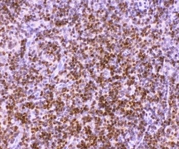 Polyclonal Rabbit anti-Human AML1 / RUNX1 Antibody (aa227-257, IHC, WB)