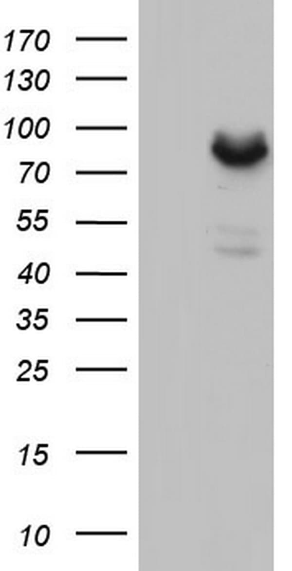 Monoclonal Mouse anti-Human MDM2 Antibody (clone OTI5E6, aa119-438, WB)