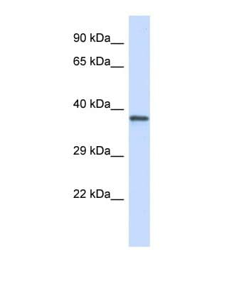GP1BA / CD42b Antibody (aa161-210)