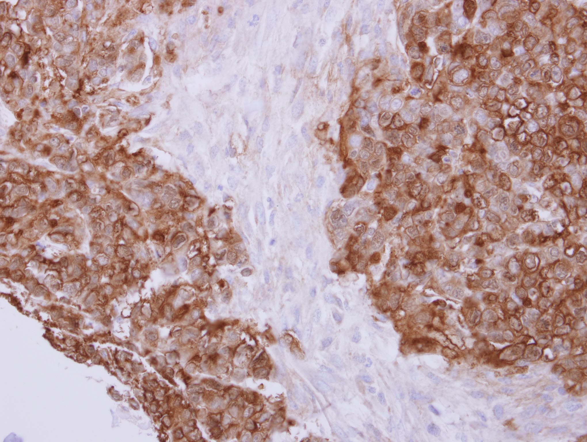 PFN2 / Profilin 2 Antibody (aa1-90)