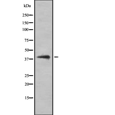 LGALS8 / Galectin 8 Antibody