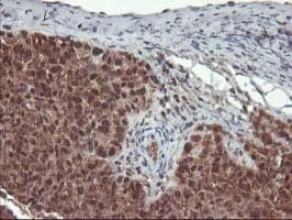 Monoclonal Mouse anti-Human LCMT1 Antibody (clone OTI2C9, IHC, WB)