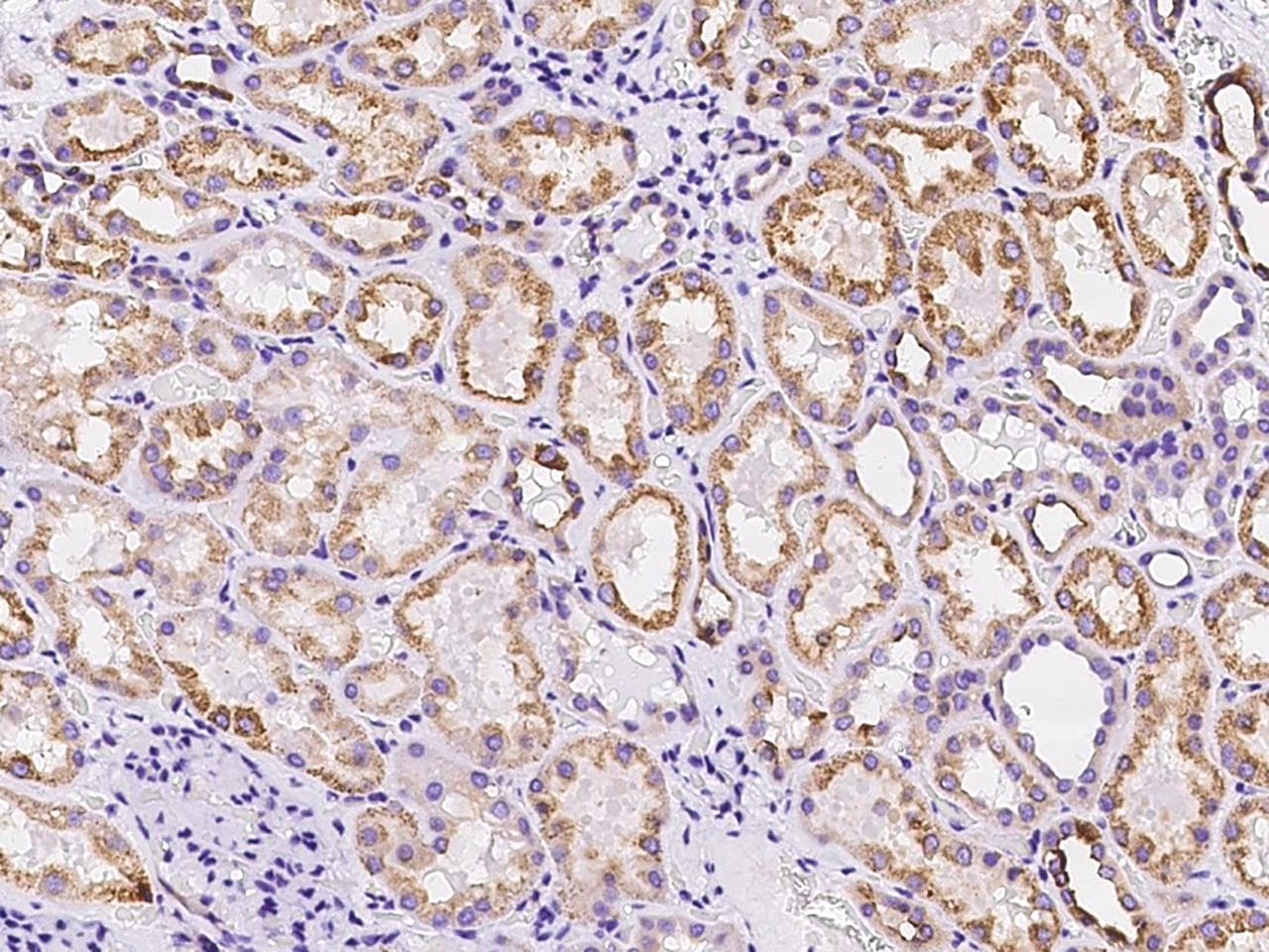 PLLP / Plasmolipin Antibody