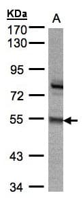 Polyclonal Rabbit anti-Human ZNF165 Antibody (aa129-461, IHC, WB)