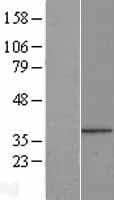 PPP1R3B Protein (Over-Expression Lysate Myc-DDK (Flag))