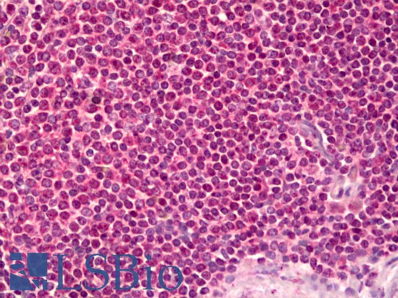 IHC-plus™ PPP2R1B Antibody (aa552-601)