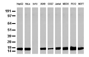 NME1 / NM23 Antibody (clone UMAB91)