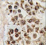 MLLT10 Antibody (aa998-1027)