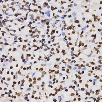 Polyclonal Rabbit anti-Human Histone H3 Antibody (Di-Methyl-Lys4, IHC, IF, WB)