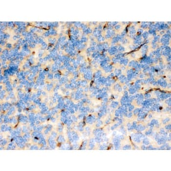 FCGRT / FCRN Antibody (aa54-291)