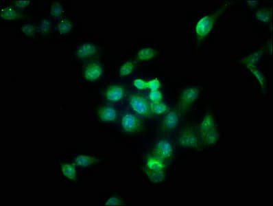 AURKB / Aurora-B Antibody