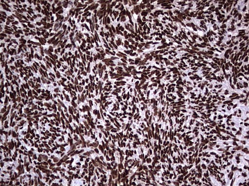 Monoclonal Mouse anti-Human HNRNPL / hnRNP L Antibody (clone OTI9G7, aa270-502, IHC, WB)