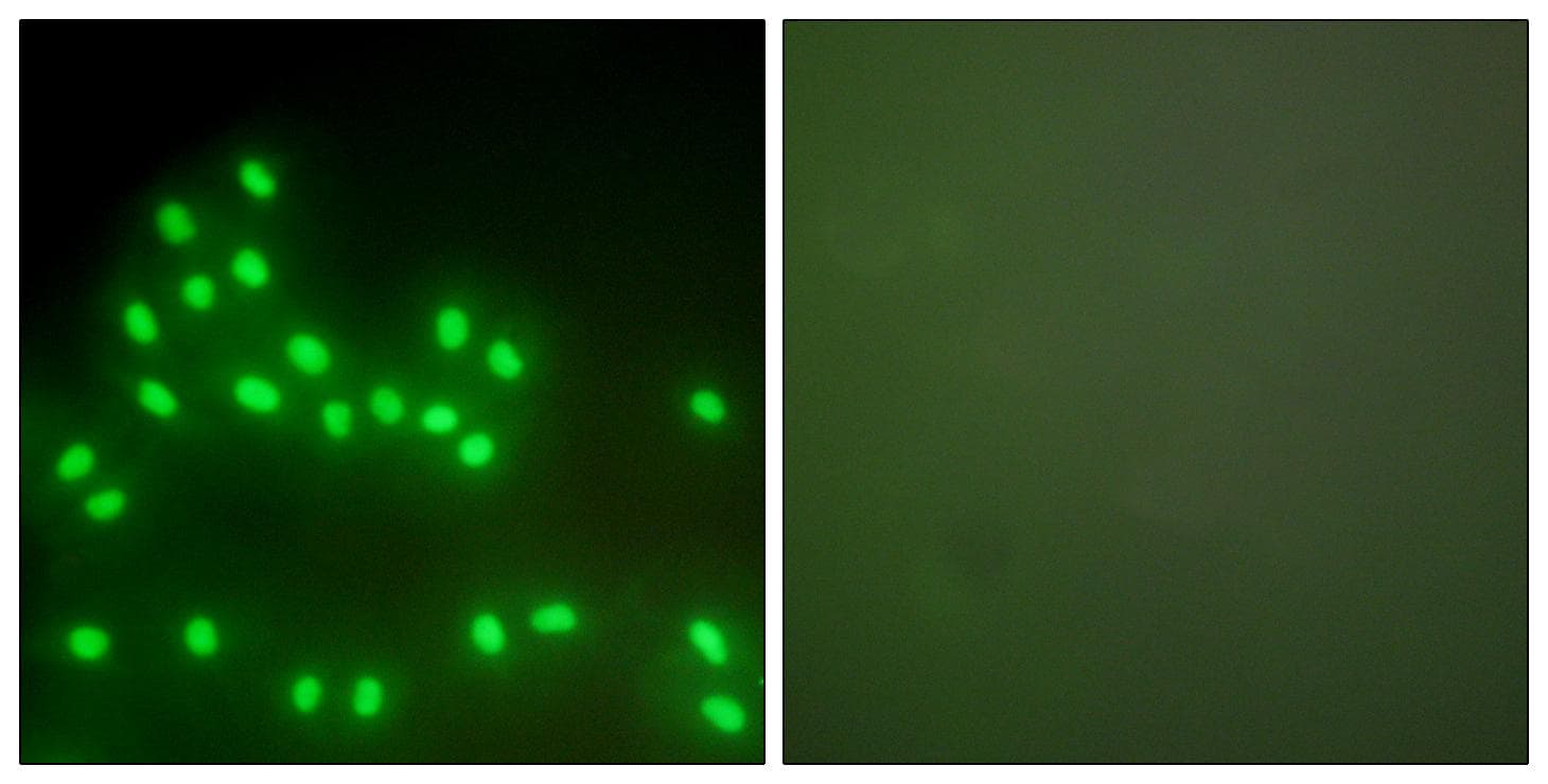 Ku70+Ku80 / XRCC6+XRCC5 Antibody