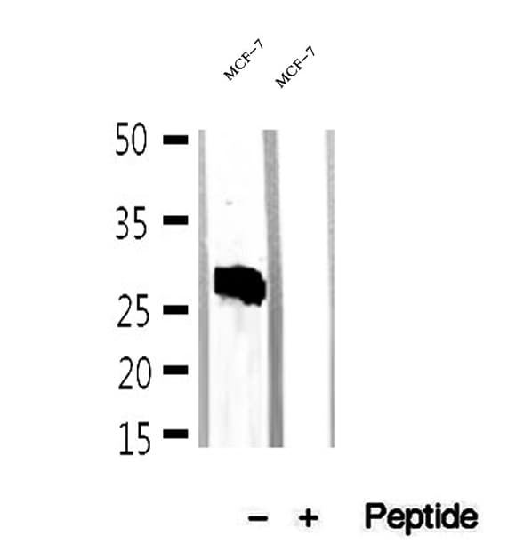 CMA1 / Mast Cell Chymase Antibody