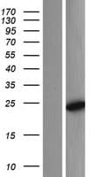 COMMD7 Protein (Over-Expression Lysate Myc-DDK (Flag))