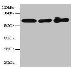 KRT6A / CK6A / Cytokeratin 6A Antibody (aa2-564)